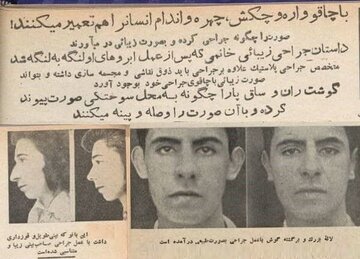 یک بانو که بینی طویل و قوزداری داشت.../ عکس یک بانو که بینی طویل و قوزداری داشت.../ عکس