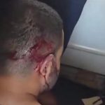 نخستین تصویر از کمک‌خلبان فلای‌دبی پس از خنثی‌سازی حمله + عکس