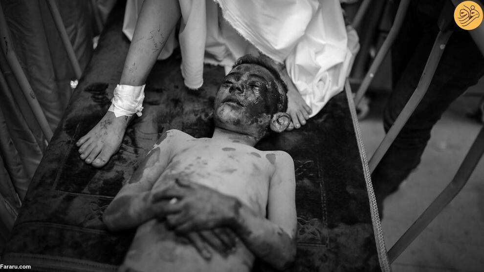 (تصاویر) غزه در خون