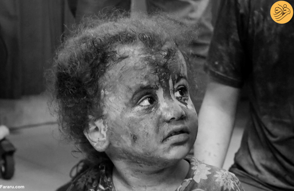 (تصاویر) هیچ پایانی برای مصیبت کودکان غزه دیده نمی‌شود