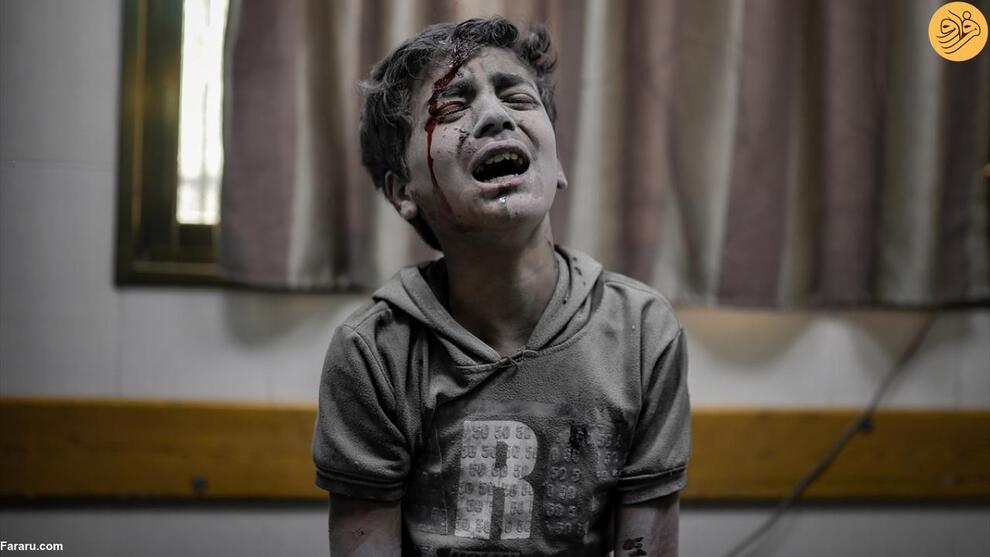 (تصاویر) هیچ پایانی برای مصیبت کودکان غزه دیده نمی‌شود