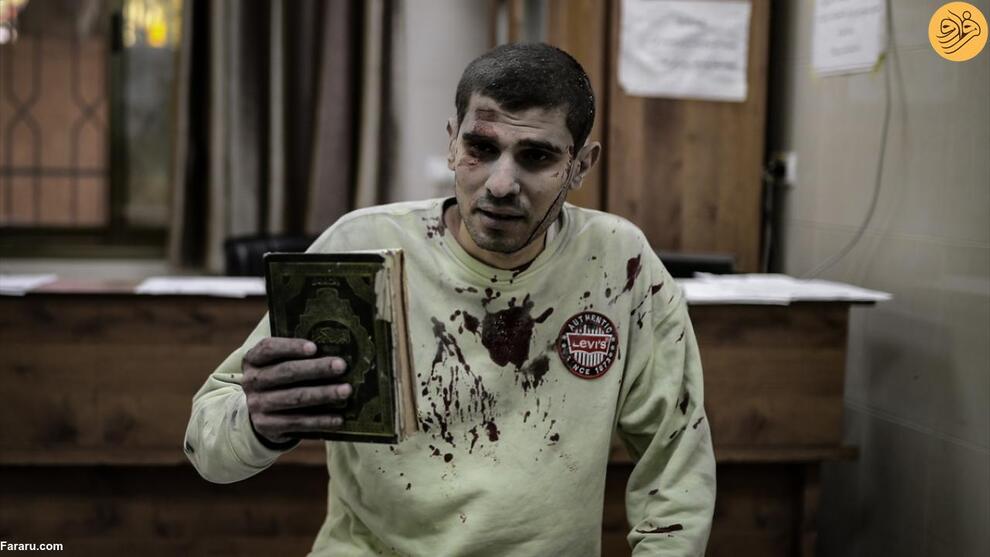 (تصاویر) هیچ پایانی برای مصیبت کودکان غزه دیده نمی‌شود