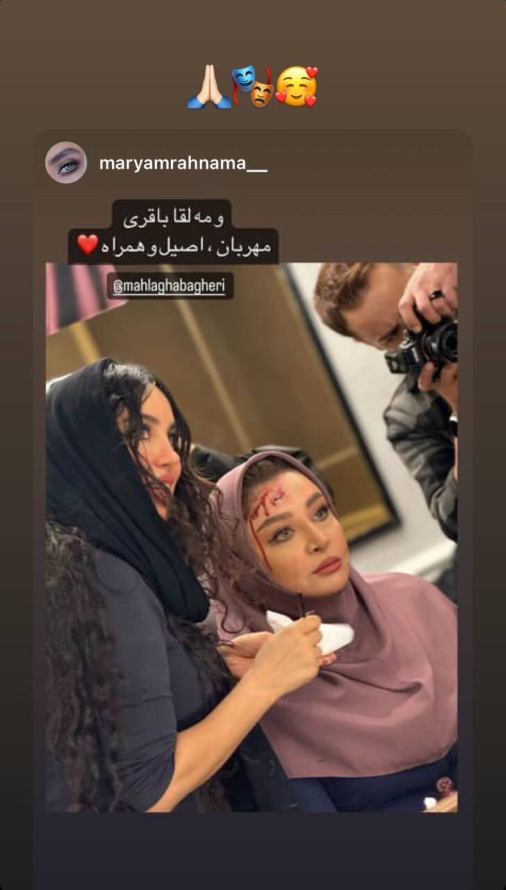 عکس | خونریزی سر مهلقا باقری در اتاق گریم عکس | خونریزی سر مهلقا باقری در اتاق گریم