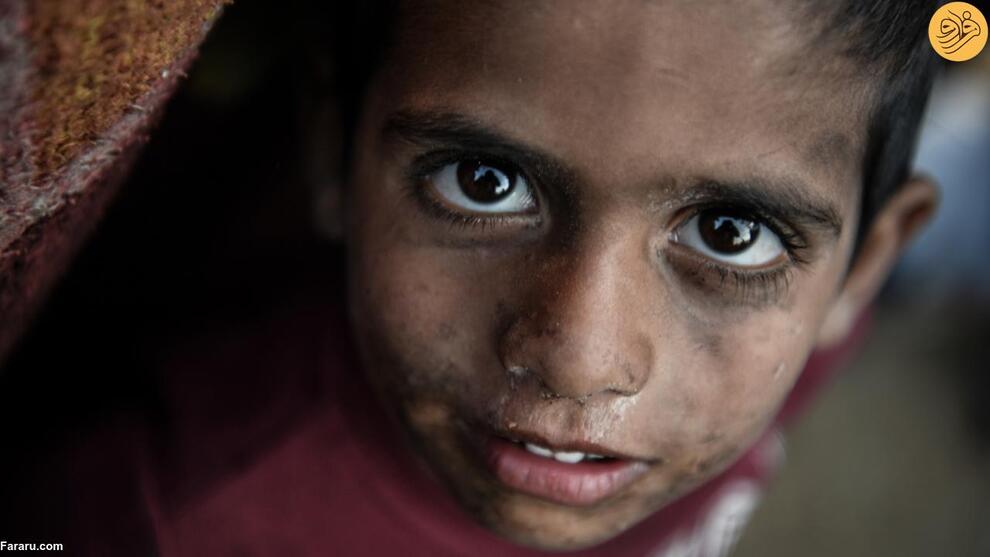 (تصاویر) کودکان غزه، قربانیان بی‌گناه جنگ