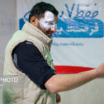 تصاویر | عکس‌های تلخ از مصدومان حادثه چهارشنبه‌سوری