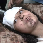 قطع عضو؛ سرنوشت تلخ کودکان معصوم فلسطینی