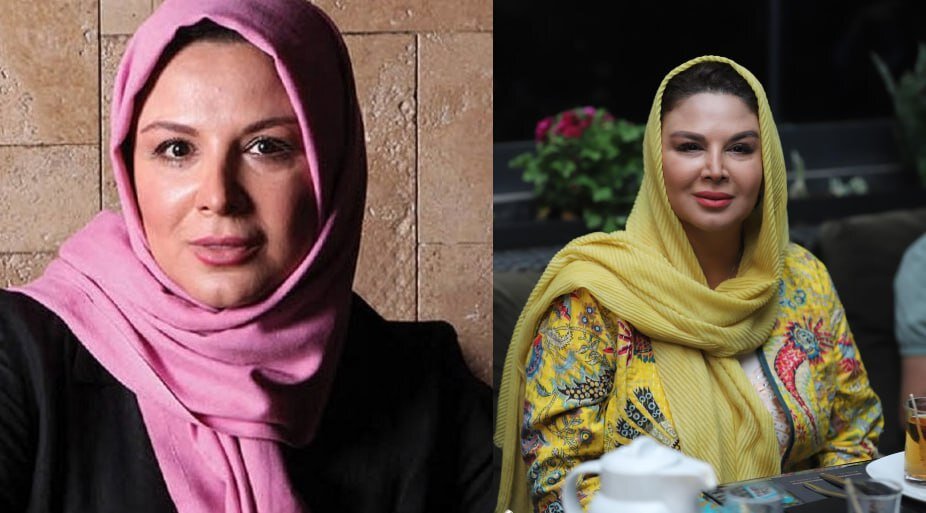 عکس | تغییر چهره عجیب شهره سلطانی بعد از عمل زیبایی!