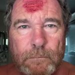 ببینید / یک عکاس خبری آمریکایی لحظه اصابت گلوله پلاستیکی به سرش را حین پوشش خبری اعتراضات ثبت کرد