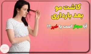 کاشت مو بعد از بارداری: آیا می‌توان انجام داد و چه نکاتی باید رعایت شود؟