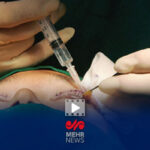 شاکی پرونده پزشک قلابی: به پزشک قانونی مراجعه کردم گفتند درست نمی‌شود