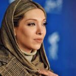 تصاویر | دندان بازیگر زن شکست؛ صدف اسپهبدی با صورت سیاه!